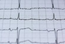 stellar energy fusion process